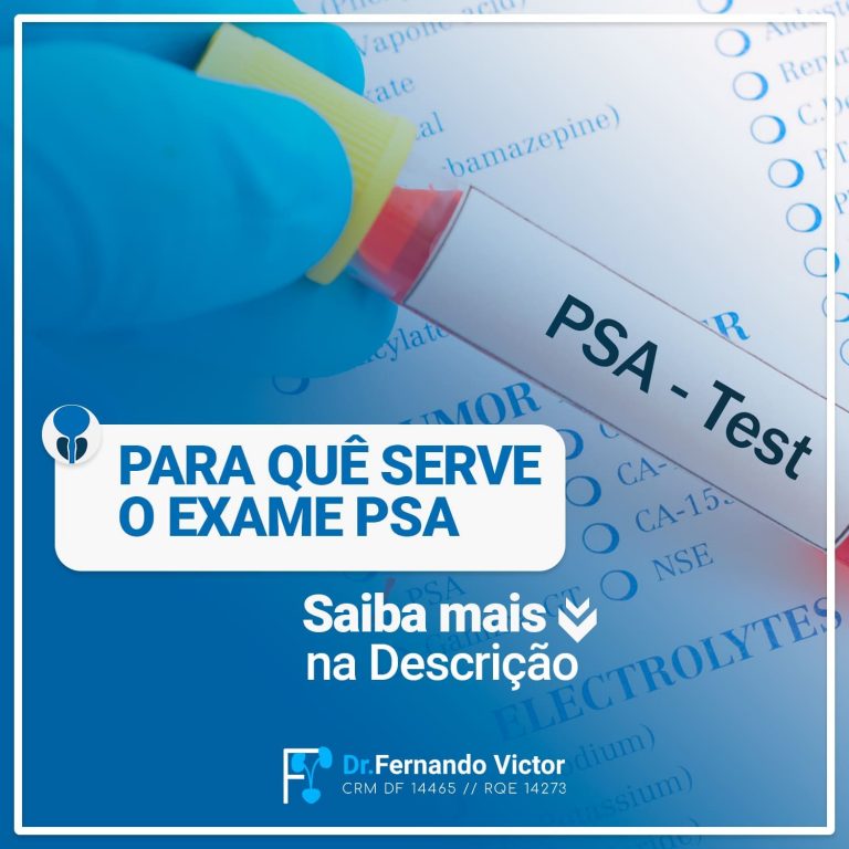 Para quê serve o exame de PSA